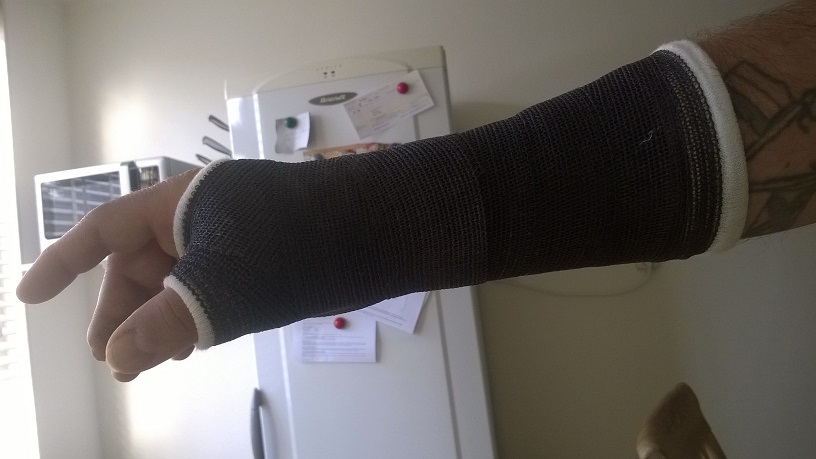 arm gips KL.jpg